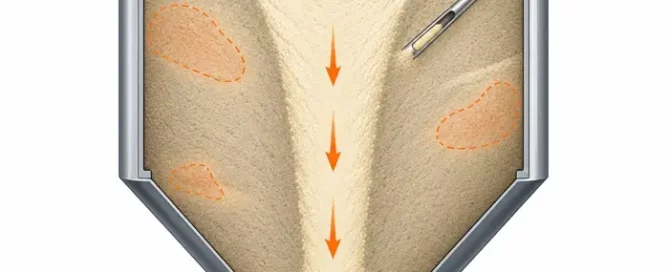 Technical illustration of a funnel-flow silo showing localized contamination zones missed by a powder sampling probe.